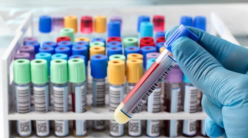 Monocitos Altos en Sangre: Causas, Síntomas y Tratamientos Efectivos para la Salud