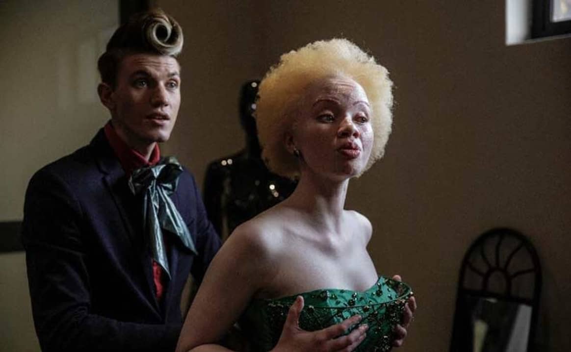 La modelo sudafricana Thando Hopa disfruta de su piel albina